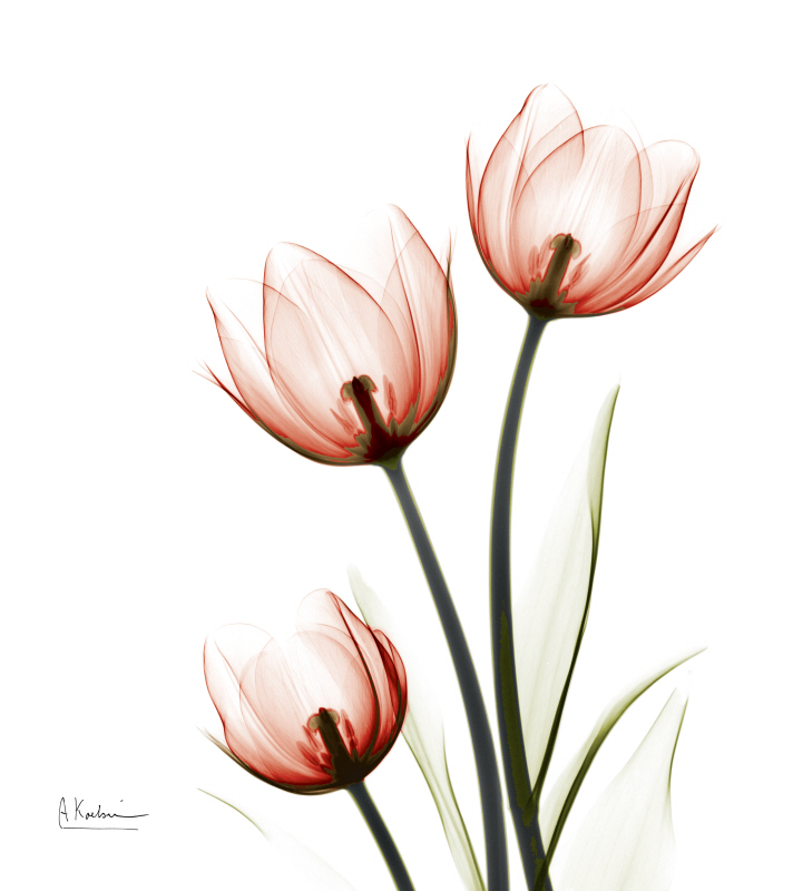 알버트 쿠치어 - Where There is Hope